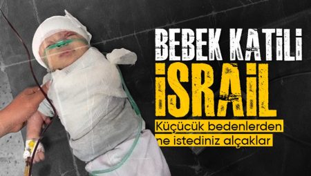 İsrail taarruzlarında kolu kopan Gazzeli minik bebek